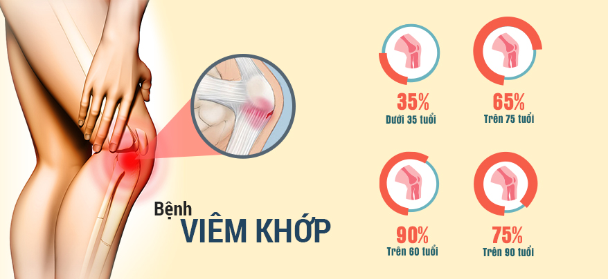 Tại sao bệnh viêm khớp gây sưng đau và cách điều trị hiệu quả?